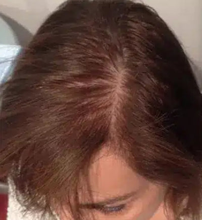 Before - Rachel T.