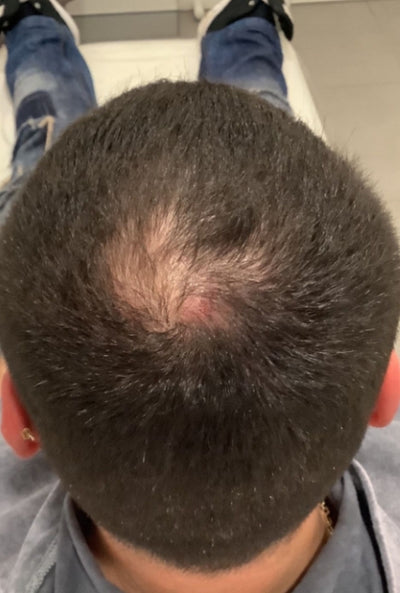 Before - Samuel M.