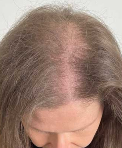 Before - Jessica L.